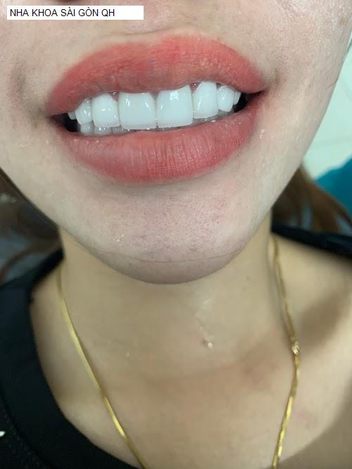 Hình ảnh NHA KHOA SÀI GÒN QH
