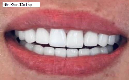 Hình ảnh Nha Khoa Tân Lập
